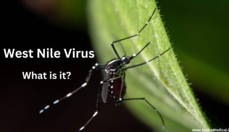 What Is West Nile Virus and How Did Dr. Fauci Catch It?