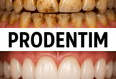 ProDentim – The #1 Natural Dental Probiotic for Healthier Teeth & Gums!